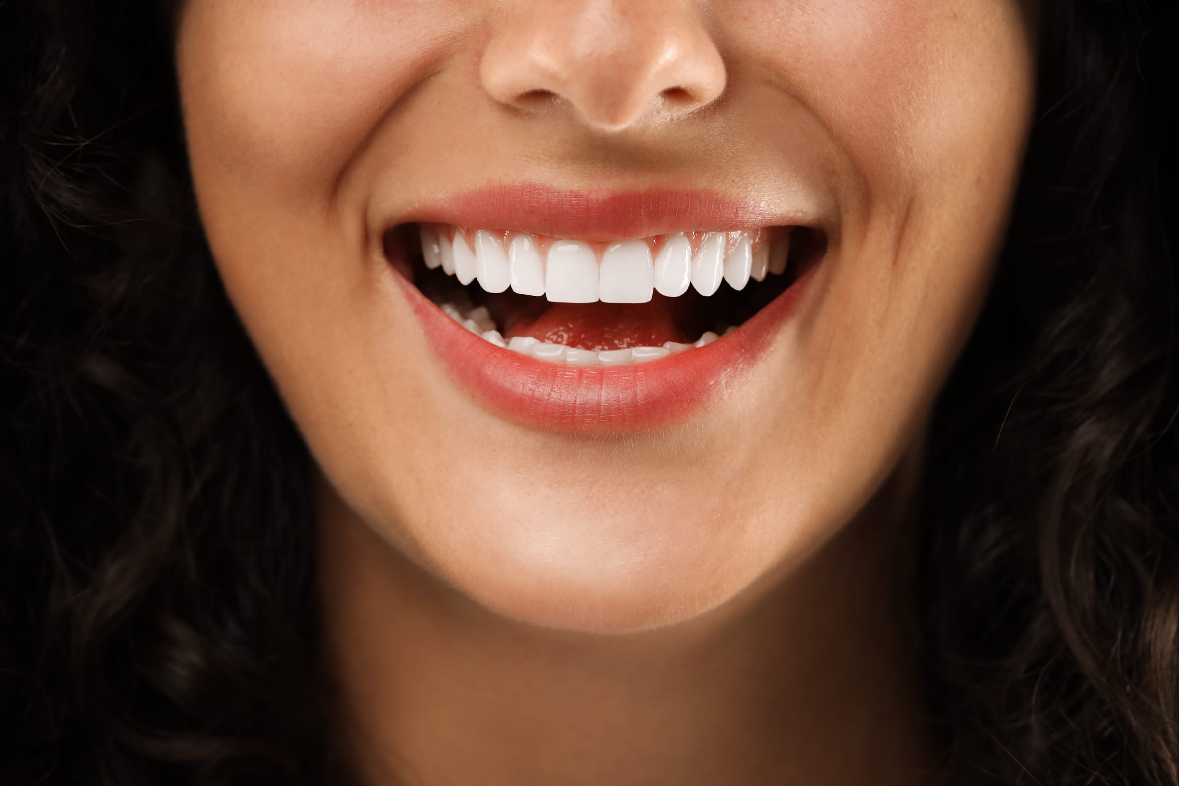 Patient smiling with natural-looking porcelain veneers